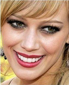 Actress Hillary Duff and fake looking Porcelain Veneers