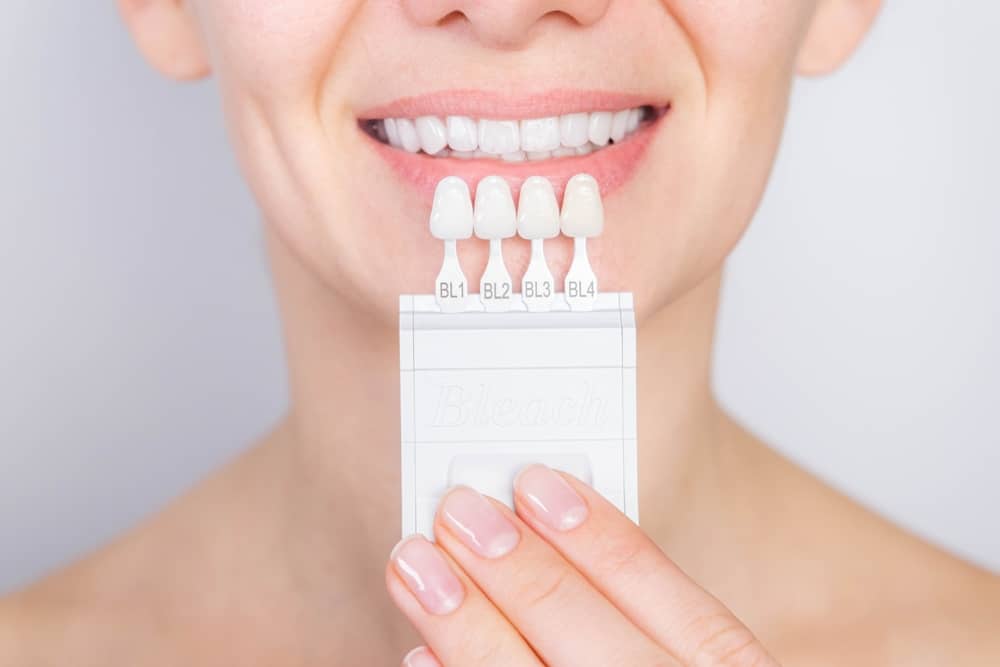 Tooth,Whitening,,Perfect,White,Teeth,Close,Up,With,Shade,Guide